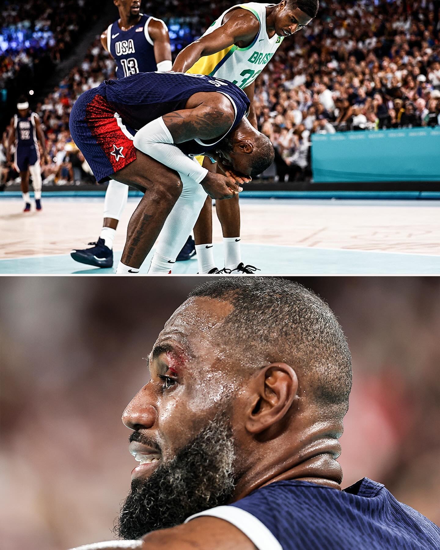 包含传奇球星勒布朗再遭伤病困扰，或将缺席关键战役的词条